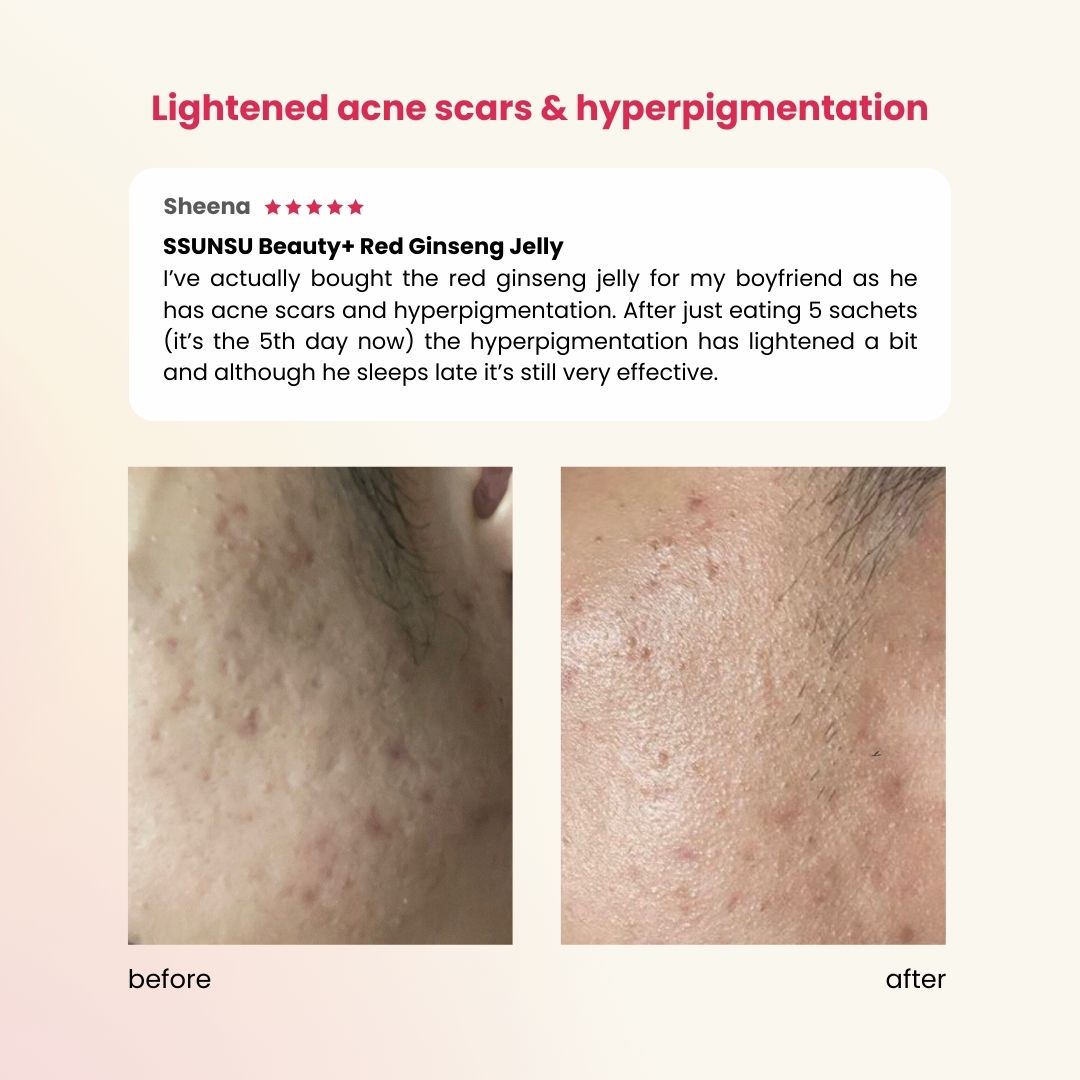 Glow Up Hyalu • Ginseng Beauty Skincare Jelly